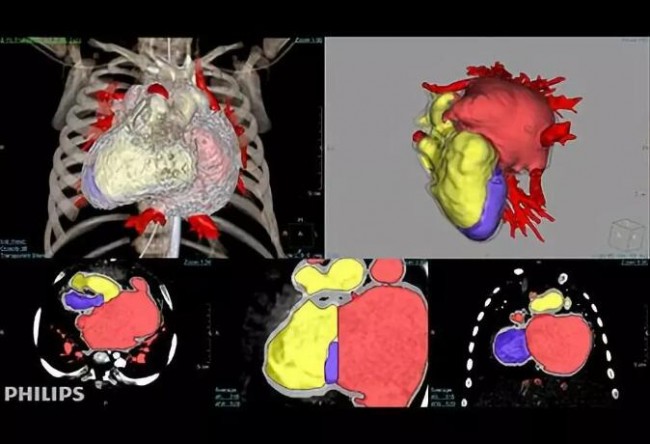 Highlights l 盤點FDA 批準的醫(yī)療模型3D打印軟件及醫(yī)學影像巨頭對該市場的滲透