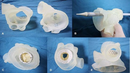逐漸納入醫保范圍的3D打印模型，將會對醫工結合帶來哪些不同？